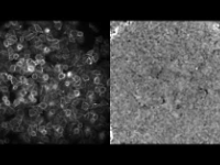 帝國理工學院 | 科學家發(fā)現(xiàn)了乳腺癌細胞潛在的“電子語言”