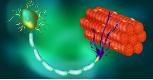 加州大学圣地亚哥分校 | DNA 治疗可以延缓几乎所有肌萎缩侧索硬化患者的麻痹
