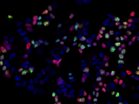 阿德莱德大学 | 雄激素研究可能为乳腺癌带来新的治疗方法