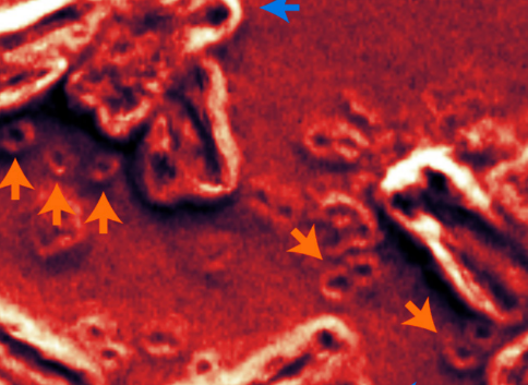 加州大学圣地亚哥分校 | 加州大学圣地亚哥分校的研究人员帮助发现微小的 DNA 环是癌症的关键驱动因素