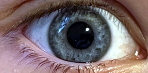 加州大学圣地亚哥分校 | 令人大开眼界的起源故事：科学家将我们类相机视觉中的关键创新追溯到细菌